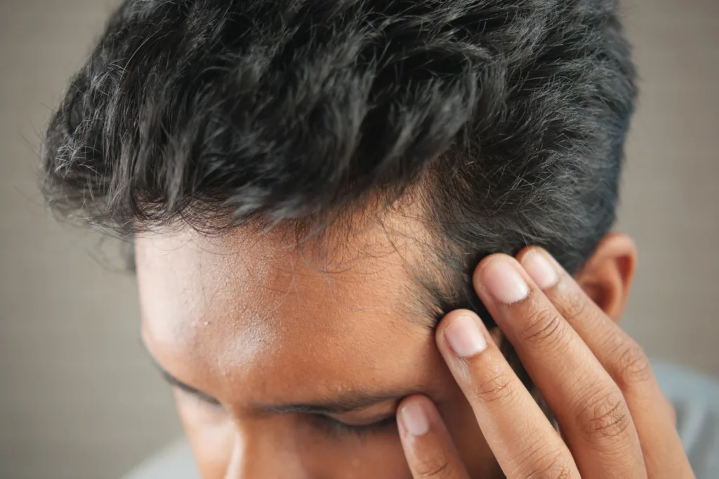 Homme qui touche ses tempes en observant sa ligne de cheveux